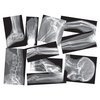 Roylco Broken Bones X-Ray Set, 15 Pieces R5914
